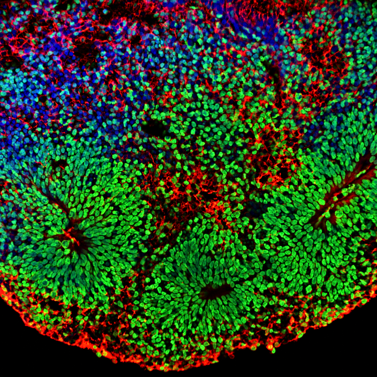Fluorescence microscopy — cortical organoid, day 30. FOXG1+ neural rosettes